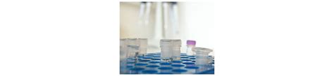 Biomarqueurs & Diagnostics pour Médecine de Précision .